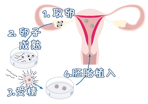 手术室